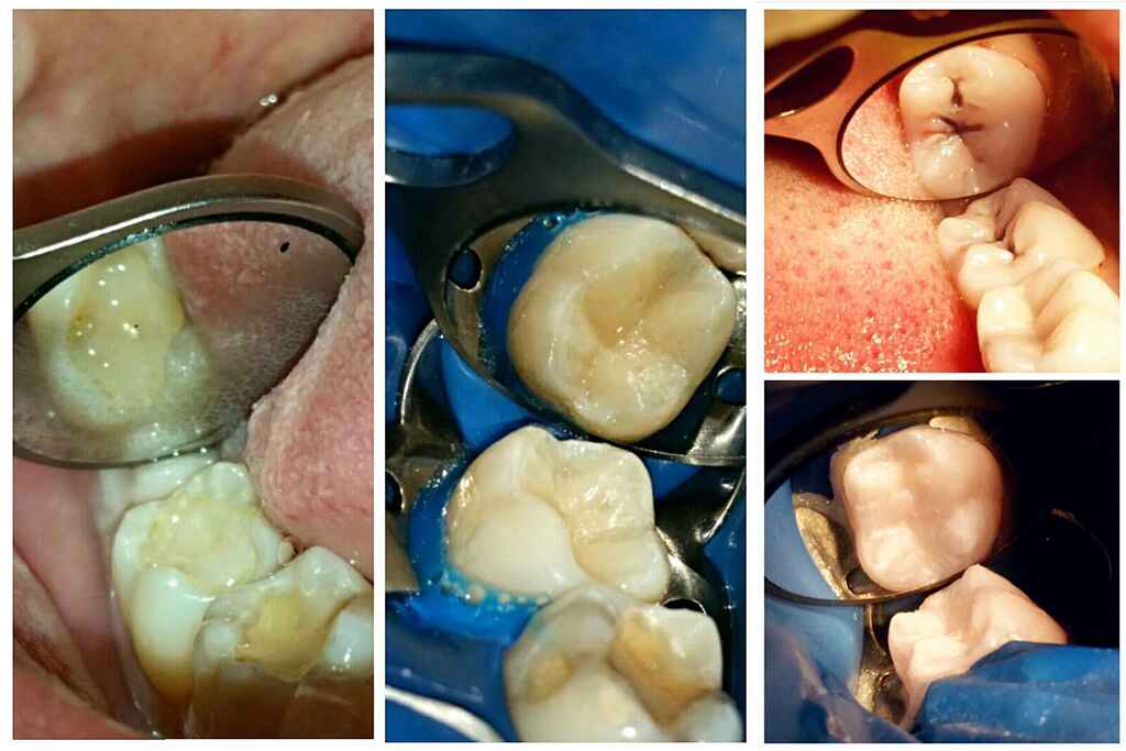 Restorative dentistry